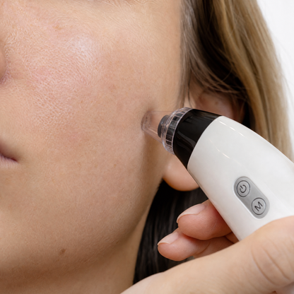 SkinVac Elite en contacto con la piel del rostro